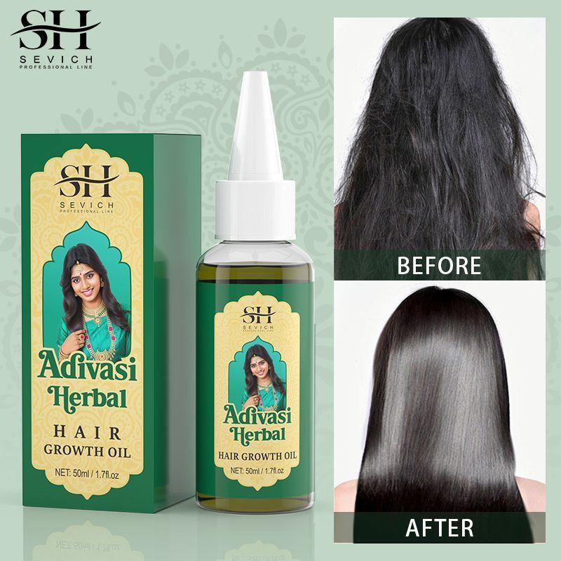 Ayurvedic & Herbal Wellness Kits - Ayurvedic Hair Growth Oil India Adivasi