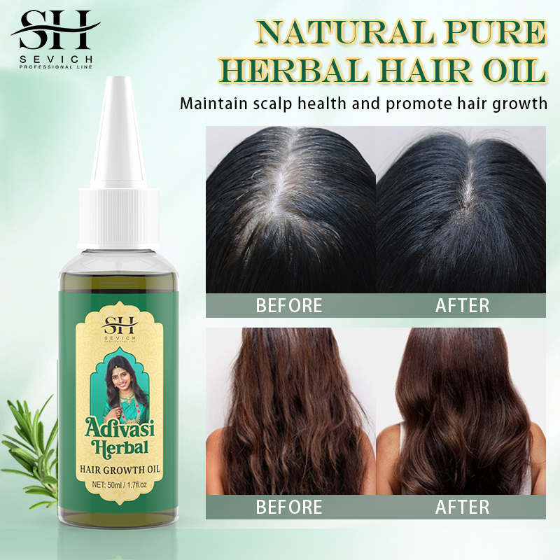 Ayurvedic Hair Growth Oil Adiv - đánh giá và giá Ayurvedic & Herbal Wellness Kits
