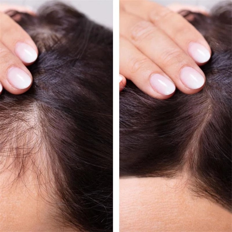 2023 Biotin Fast Hair Growth O - đánh giá và giá Licorice Root Sticks